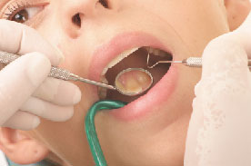 Arten der Zahnbehandlung